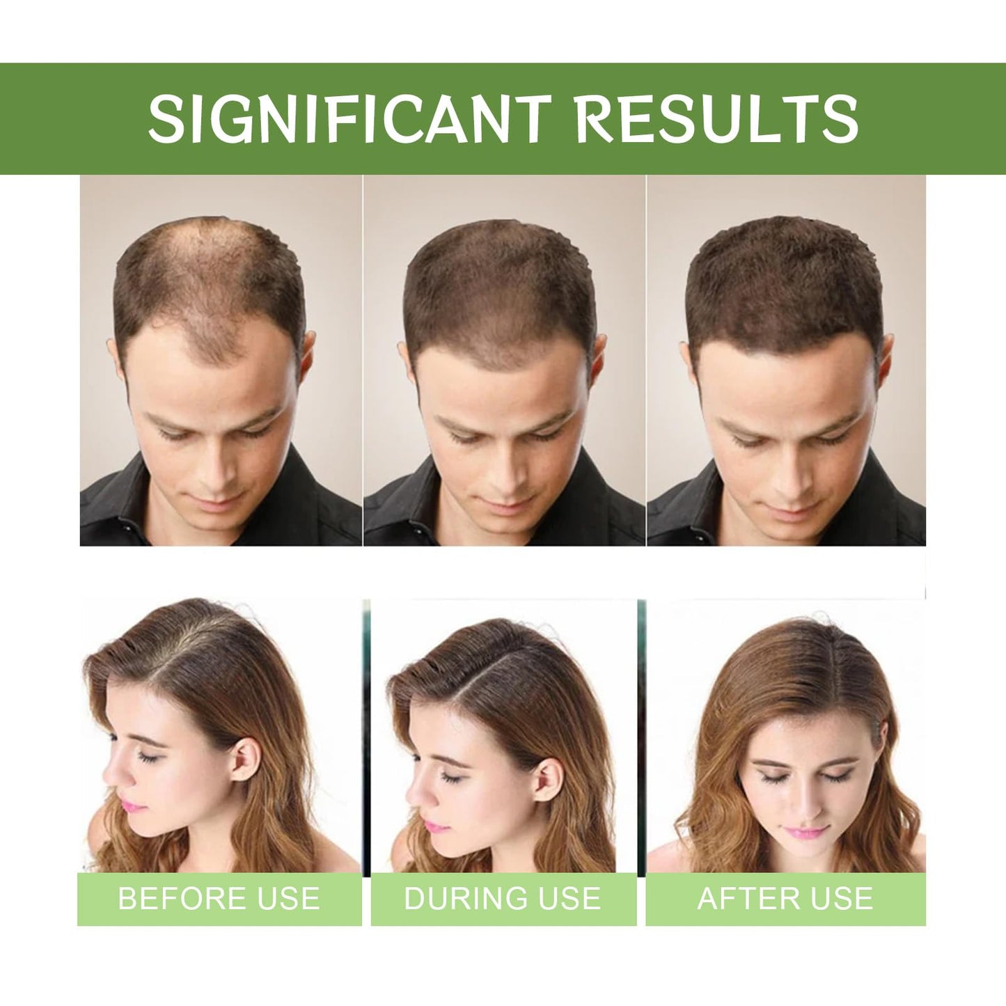 Hair Regrowth System, Advanced Hair Growth Treatment Serum | Ginseng, Eclipta Prostrata, Peppermint Oil and Ginger Root-Ingrown Hair Treatment-Strengthens Roots, For Men and Women (1PCS)